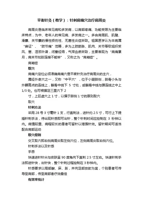 平衡针灸（教学）：针刺肩痛穴治疗肩周炎