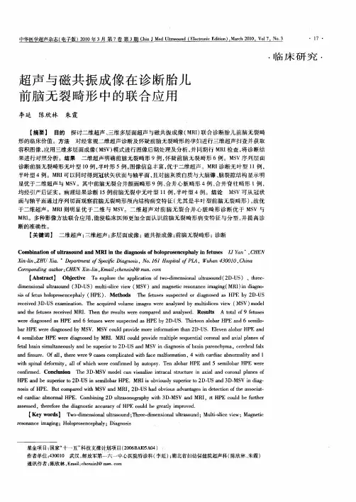 超声与磁共振成像在诊断胎儿前脑无裂畸形中的联合应用