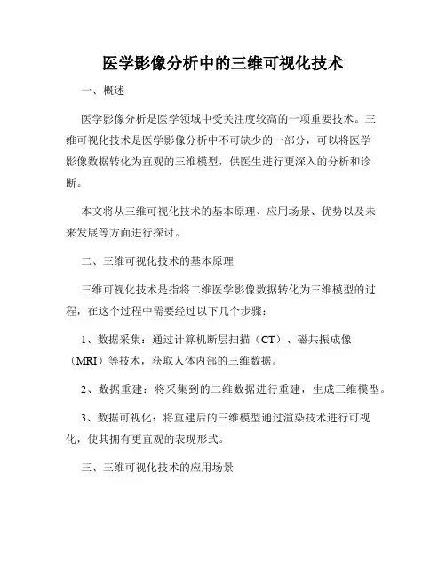 医学影像分析中的三维可视化技术