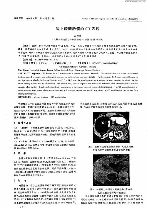 肾上腺畸胎瘤的CT表现