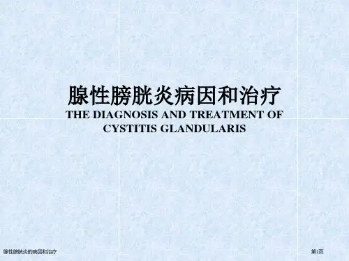 腺性膀胱炎的病因和治疗
