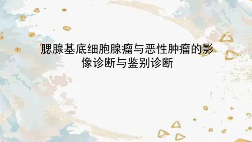 腮腺基底细胞腺瘤与恶性肿瘤的影像诊断与鉴别诊断
