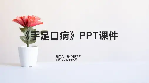 《手足口病》课件