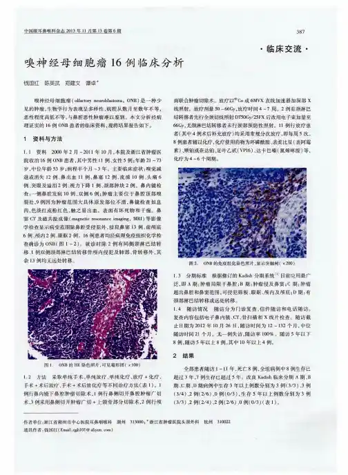 嗅神经母细胞瘤16例临床分析