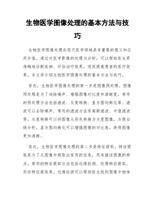 生物医学图像处理的基本方法与技巧