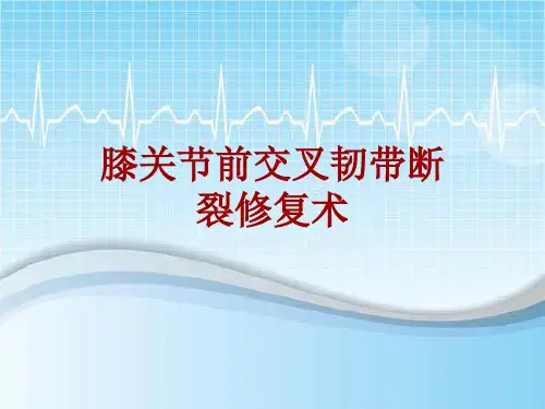 外科手术教学资料：膝关节前交叉韧带断裂修复术讲解模板