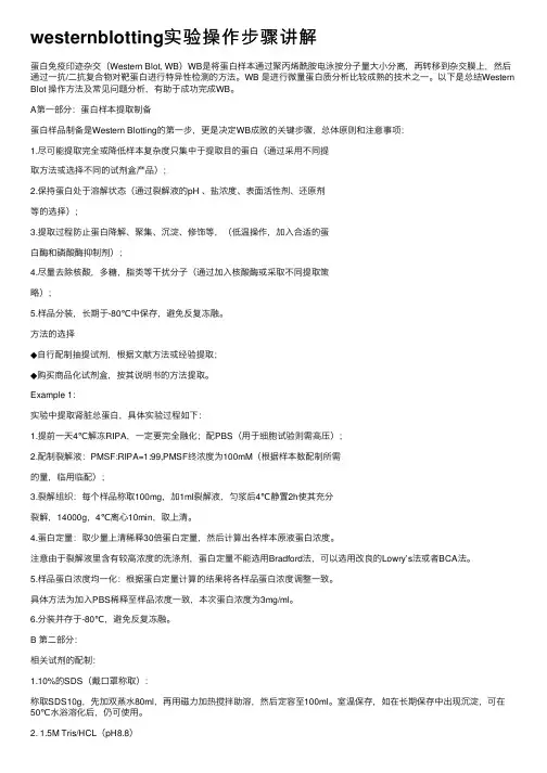 westernblotting实验操作步骤讲解