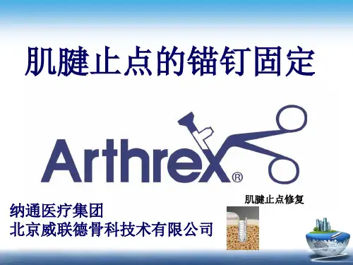 锚钉在肌腱止点的使用