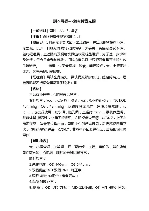 溯本寻源---激素性青光眼