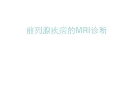 前列腺疾病的MRI诊断ppt课件