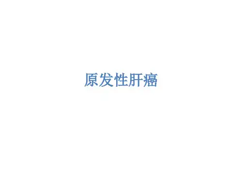 原发性肝癌护理要点