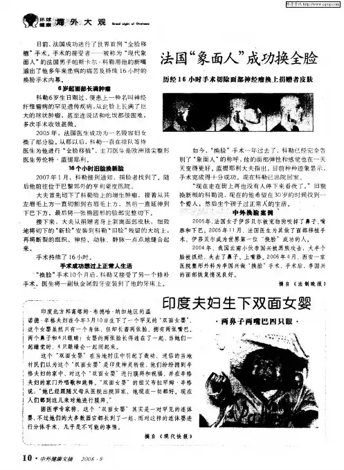 法国“象面人”成功换全脸