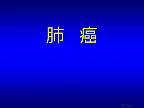 肺癌胸外科ppt课件