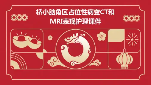 桥小脑角区占位性病变CT和MRI表现护理课件
