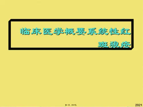 临床医学概要系统性红斑狼疮优秀课件(共57张PPT)