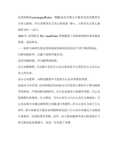 法洛四联症