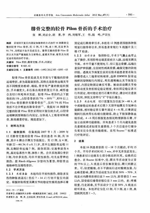 腓骨完整的胫骨Pilon骨折的手术治疗