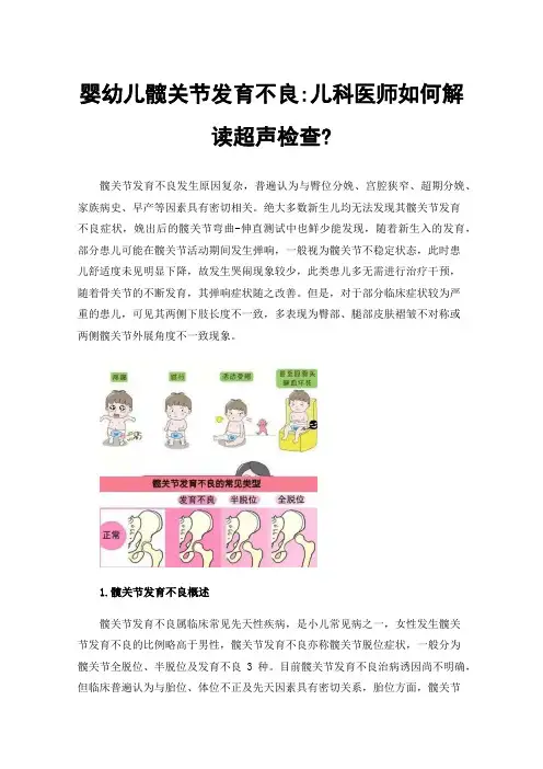 婴幼儿髋关节发育不良:儿科医师如何解读超声检查?