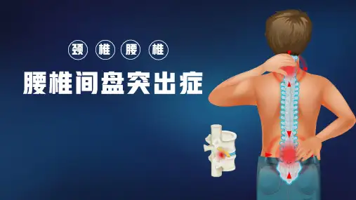 腰椎间盘突出症