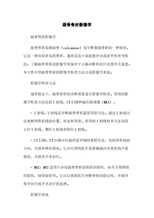 跟骨骨折影像学