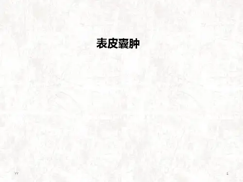 表皮囊肿医学PPT