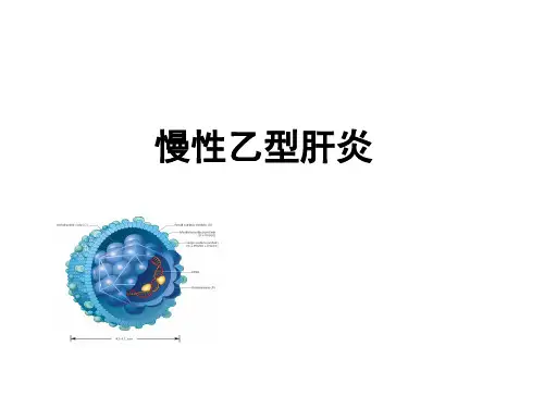 慢性乙型肝炎PPT课件