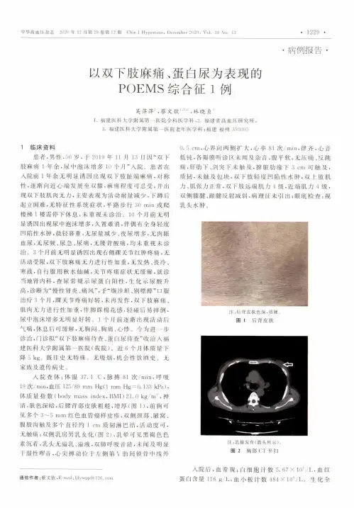 以双下肢麻痛、蛋白尿为表现的 POEMS综合征1例