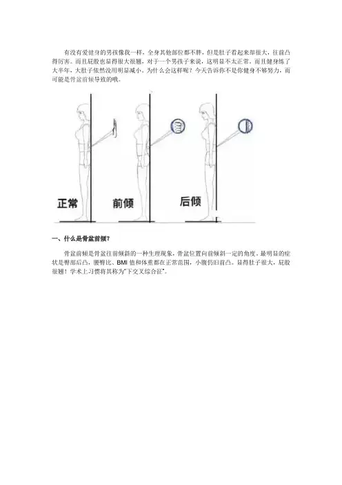 骨盆前倾如何矫正