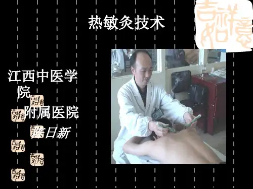 热敏灸培训详解