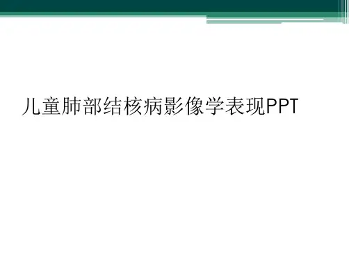 儿童肺部结核病影像学表现PPT