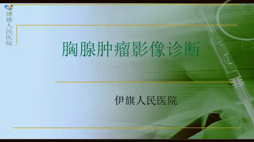 胸腺瘤影像诊断