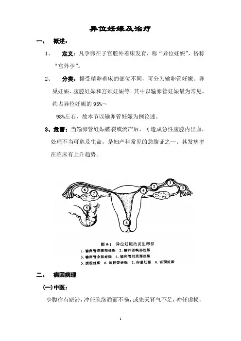异位妊娠及治疗