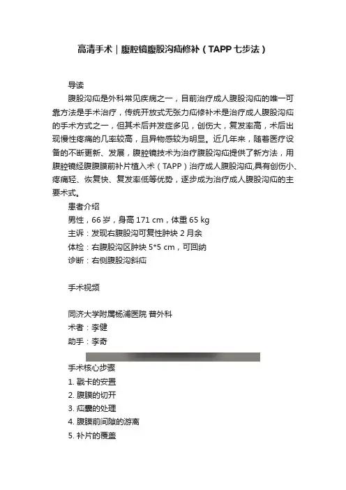 高清手术｜腹腔镜腹股沟疝修补（TAPP七步法）