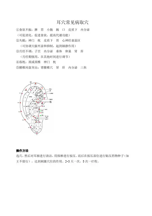耳穴压豆