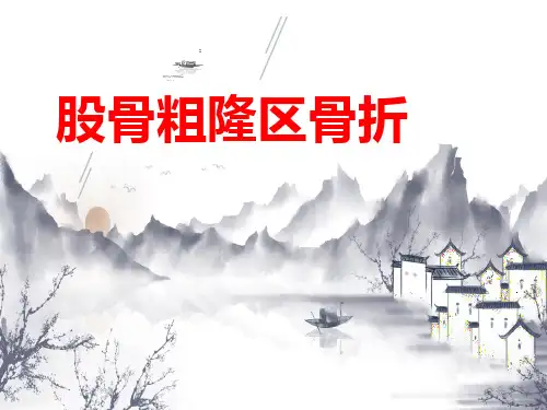 股骨粗隆间骨折PPT课件
