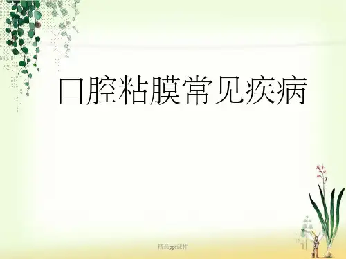 《口腔黏膜常见疾病》PPT课件