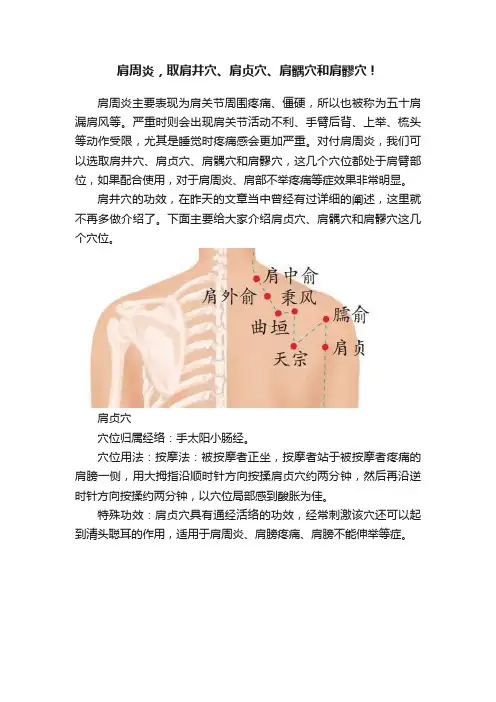 肩周炎，取肩井穴、肩贞穴、肩髃穴和肩髎穴！