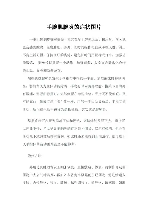 手腕肌腱炎的症状图片