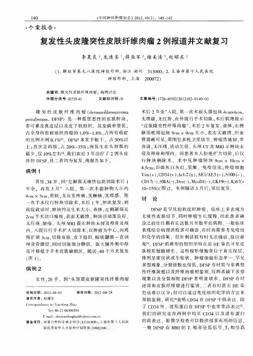 复发性头皮隆突性皮肤纤维肉瘤2例报道并文献复习