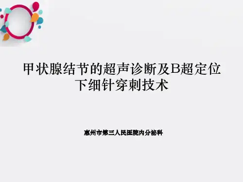 甲状腺结节的超声诊断及B超定位下细针穿刺技术