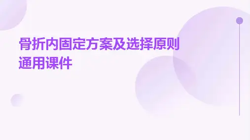骨折内固定方案及选择原则通用课件