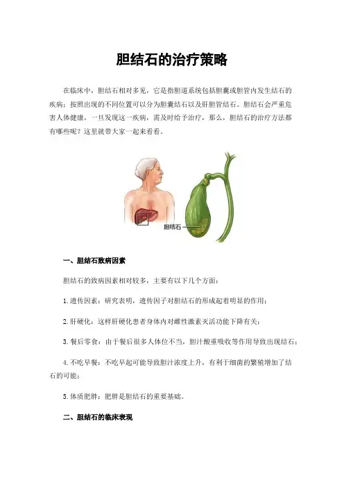 胆结石的治疗策略