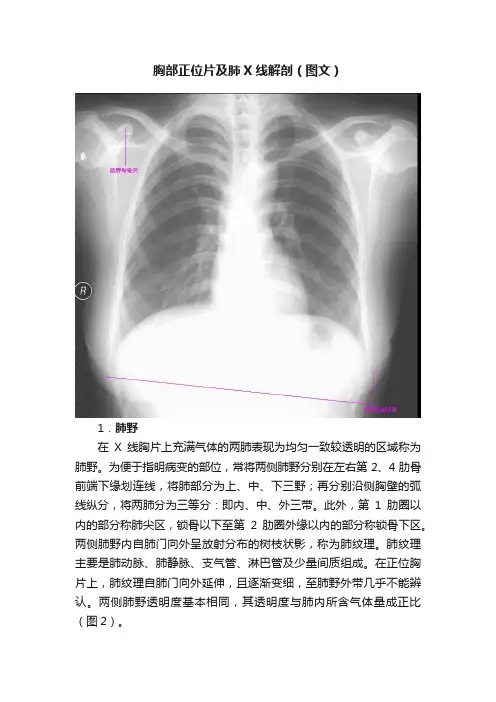 胸部正位片及肺X线解剖（图文）