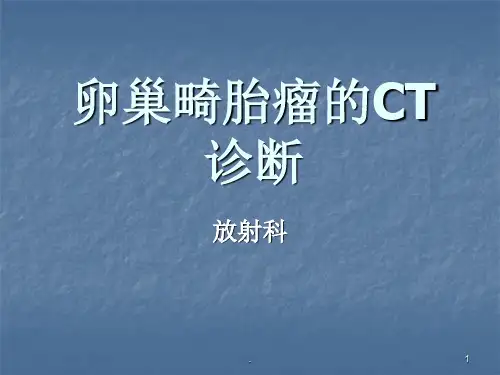 卵巢畸胎瘤CT诊断PPT课件