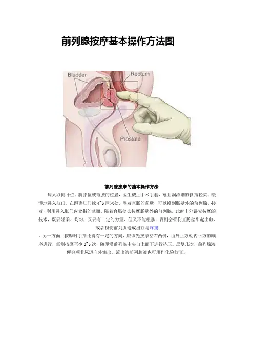 前列腺按摩基本操作方法图