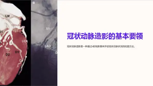 冠状动脉造影的基本要领