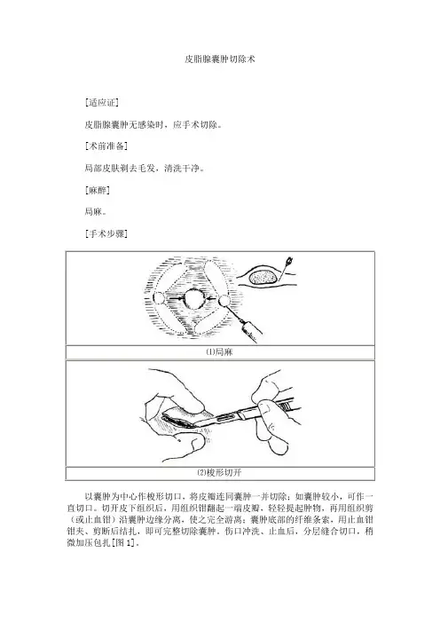 皮脂腺囊肿切除术图谱