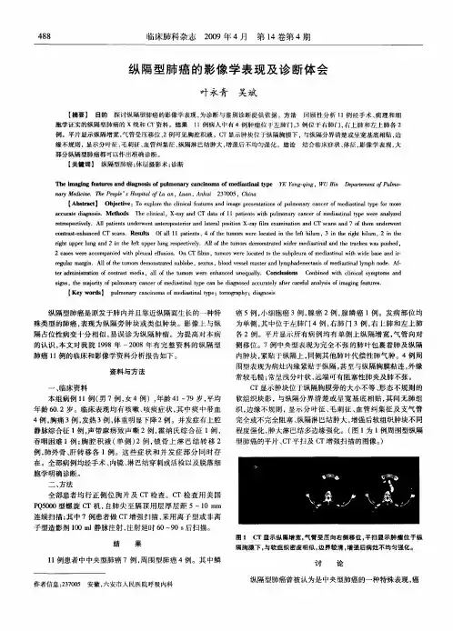 纵隔型肺癌的影像学表现及诊断体会