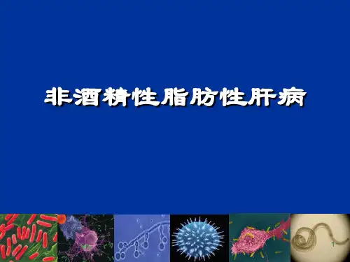 非酒精性脂肪性肝病PPT幻灯片课件