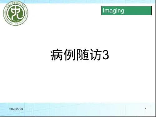 神经纤维瘤病总结